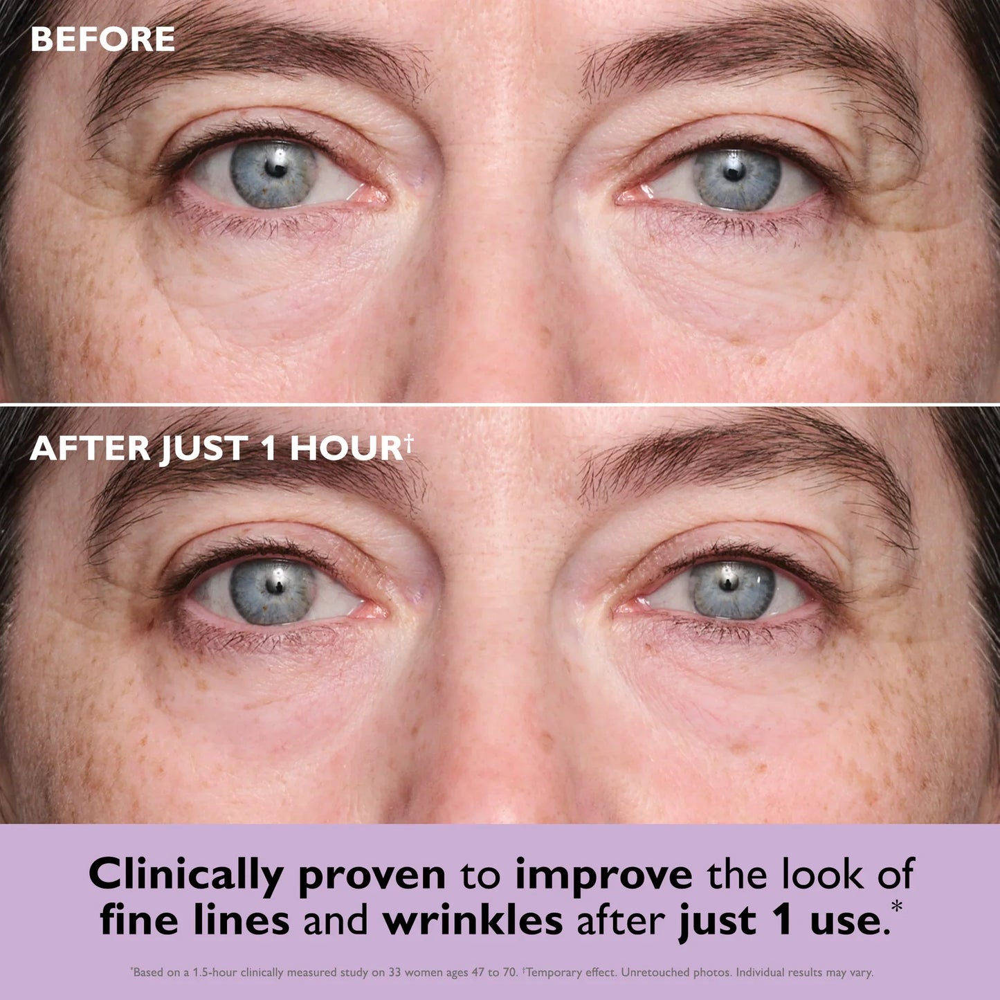 Final 3 Hours🔥COLLAGEN INFUSION TIGHTENING EYE PATCHES