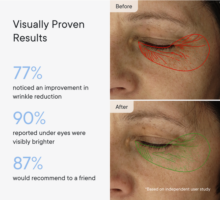 Micro-Infusion Targeted Patches - Smooth and Plump stubborn areas