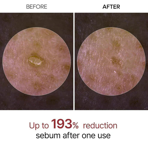 Letzte 3 Stunden: 50 % RABATT🔥 Sanftes Peeling Glow Rice Ampoule – Geeignet für alle Hauttypen
