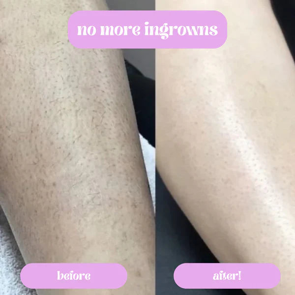 Herglw™ Razor Pro