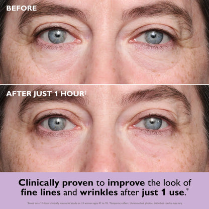 Final 3 Hours🔥COLLAGEN INFUSION TIGHTENING EYE PATCHES