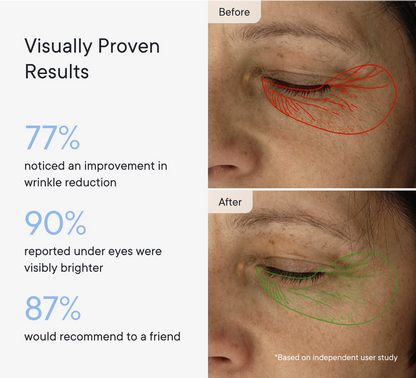 Micro-Infusion Targeted Patches - Smooth and Plump stubborn areas