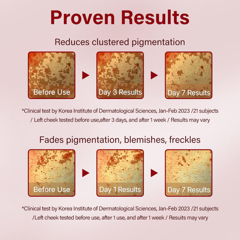 Madeca Time Reverse  - Ultimate Lift - 🔥 LAST DAY 49% OFF