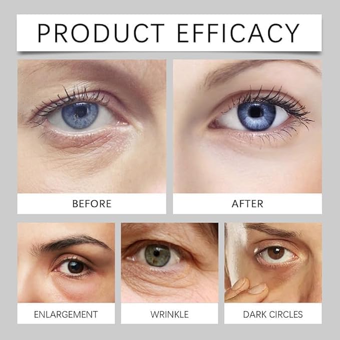 Lumibalm Turmeric & Retinol Eye Stick for Under-Eye Bags