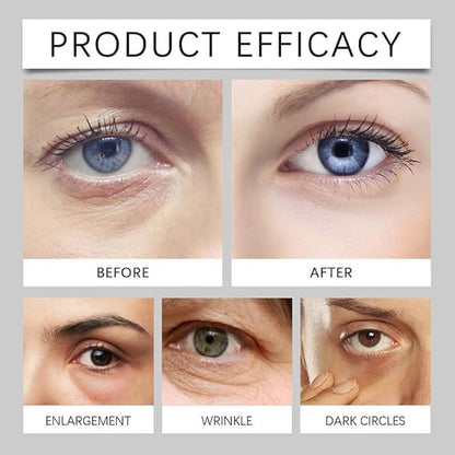 Lumibalm Turmeric & Retinol Eye Stick for Under-Eye Bags