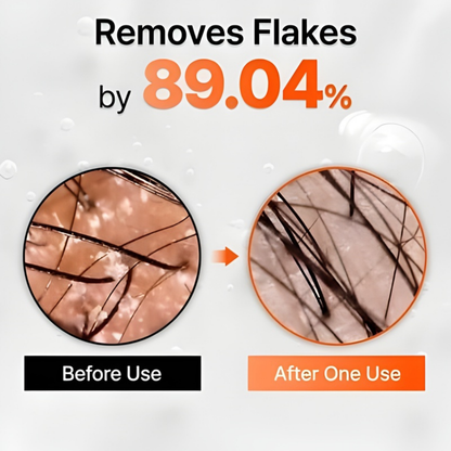 Growturn Hair Growth Serum with Built in Brush