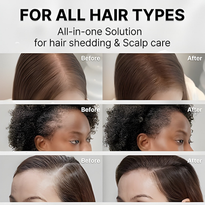 Growturn Hair Growth Serum with Built in Brush