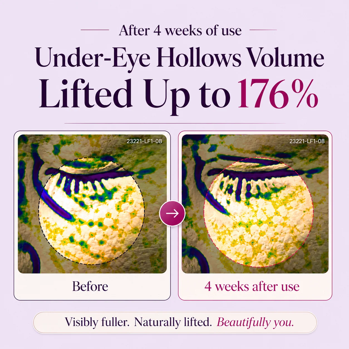 HERGLW™ Calcium Peptide Eye Cream