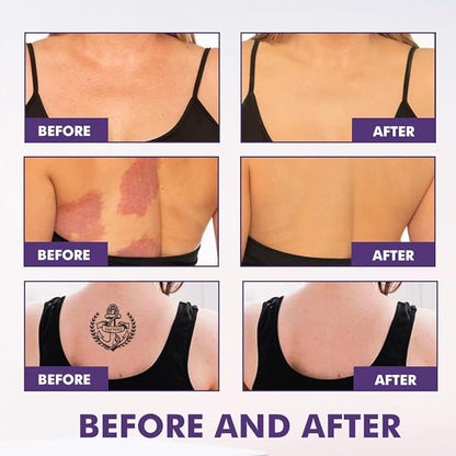 Body Coverage Perfector – Waterproof Tattoo & Scar Concealer 60ml