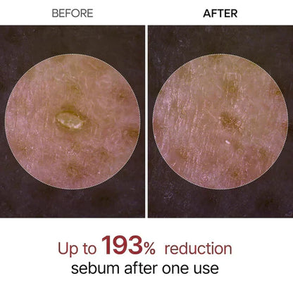 Letzte 3 Stunden: 50 % RABATT🔥 Sanftes Peeling Glow Rice Ampoule – Geeignet für alle Hauttypen