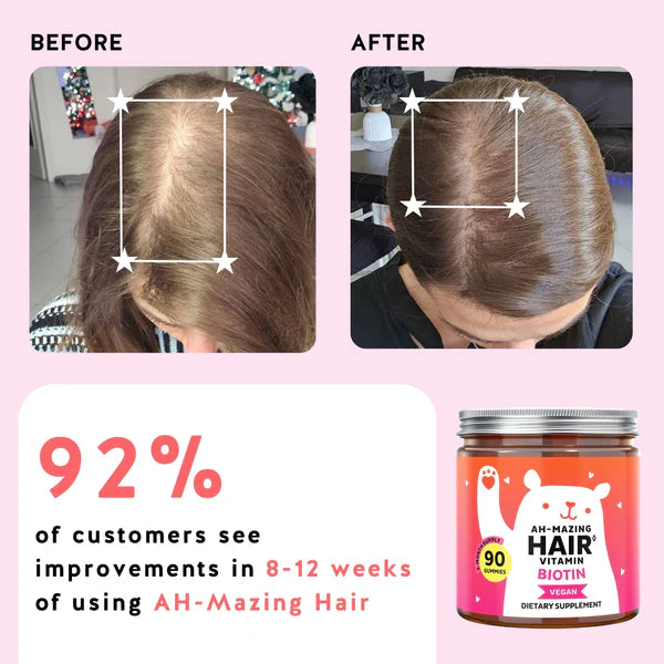 5000mcg Biotin Gummies – Vegan Wild Berry Hair Vitamins