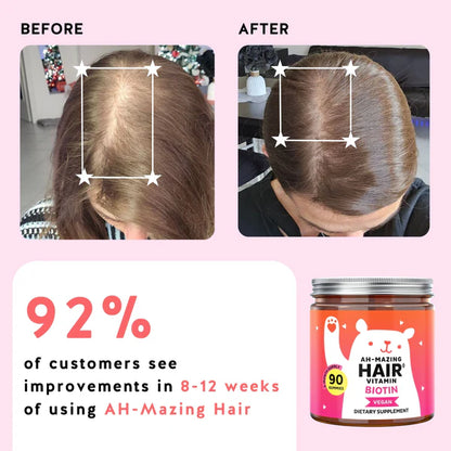 5000mcg Biotin Gummies – Vegan Wild Berry Hair Vitamins