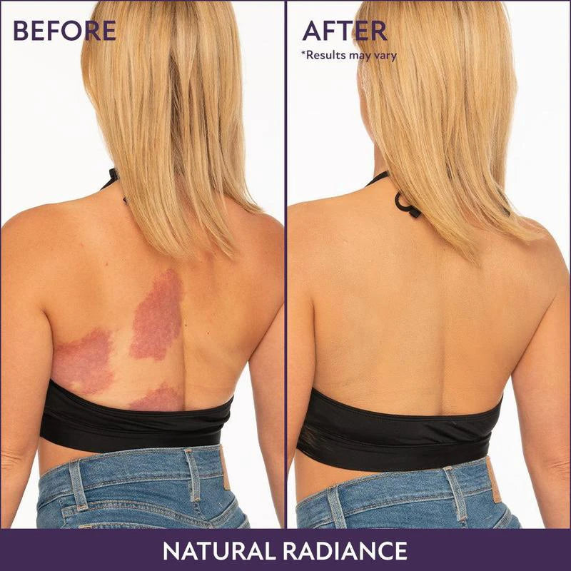 Body Coverage Perfector – Waterproof Tattoo & Scar Concealer 60ml