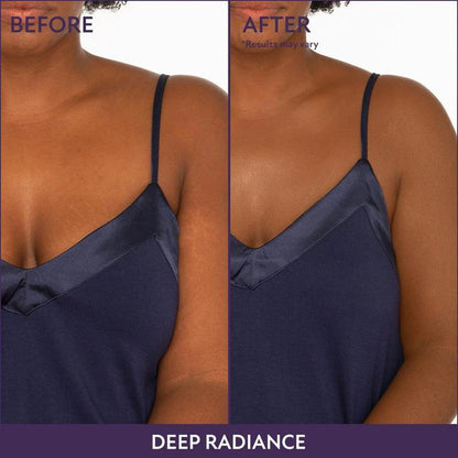 Body Coverage Perfector – Waterproof Tattoo & Scar Concealer 60ml