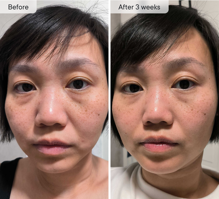 Micro-Infusion Targeted Patches - Smooth and Plump stubborn areas