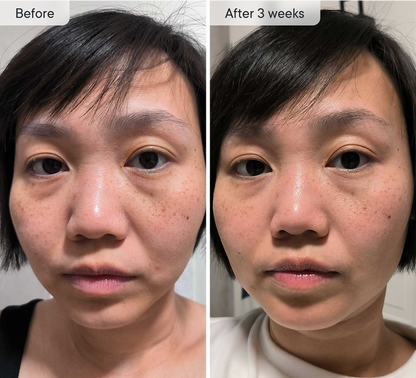 Micro-Infusion Targeted Patches - Smooth and Plump stubborn areas