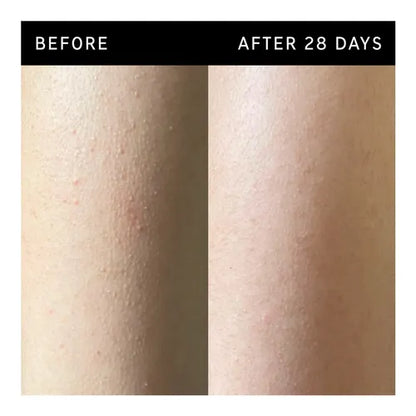 Glycolic Acid Exfoliating Body Stick -  KP & Ingrown Hair Relief