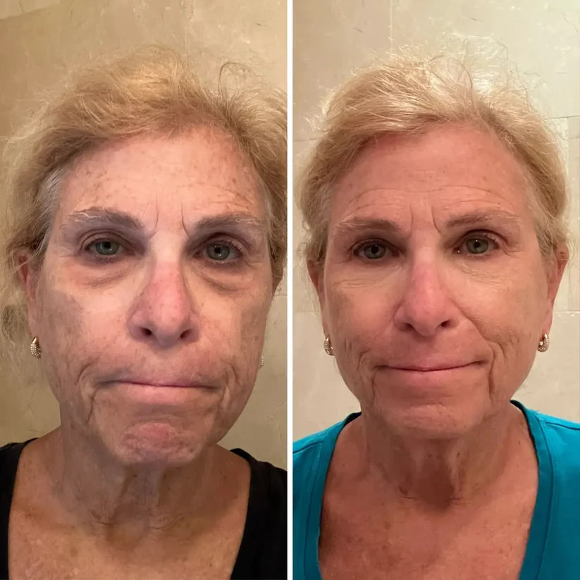 Lumibalm Turmeric & Retinol Eye Stick for Under-Eye Bags