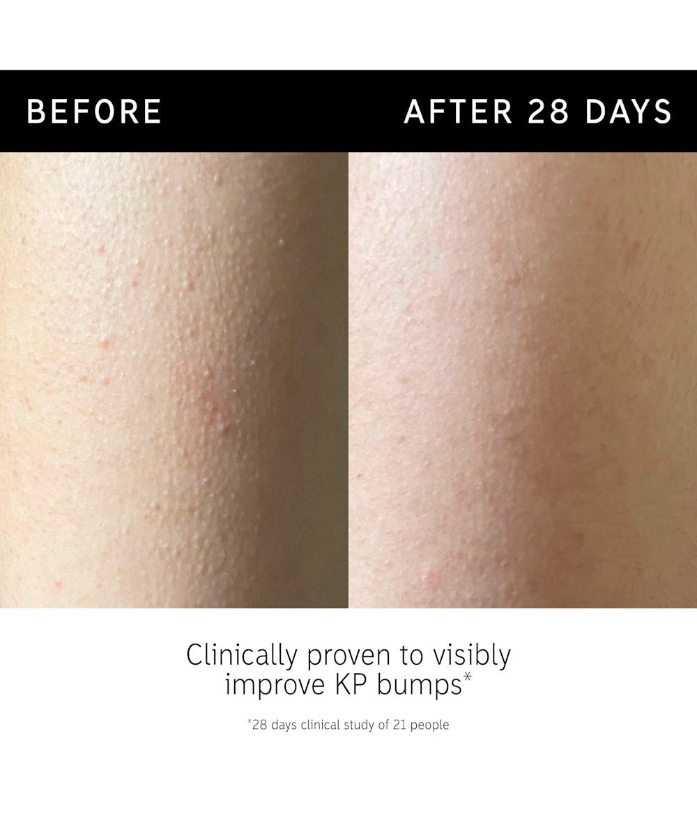Glycolic Acid Exfoliating Body Stick -  KP & Ingrown Hair Relief
