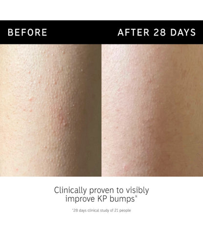 Glycolic Acid Exfoliating Body Stick -  KP & Ingrown Hair Relief