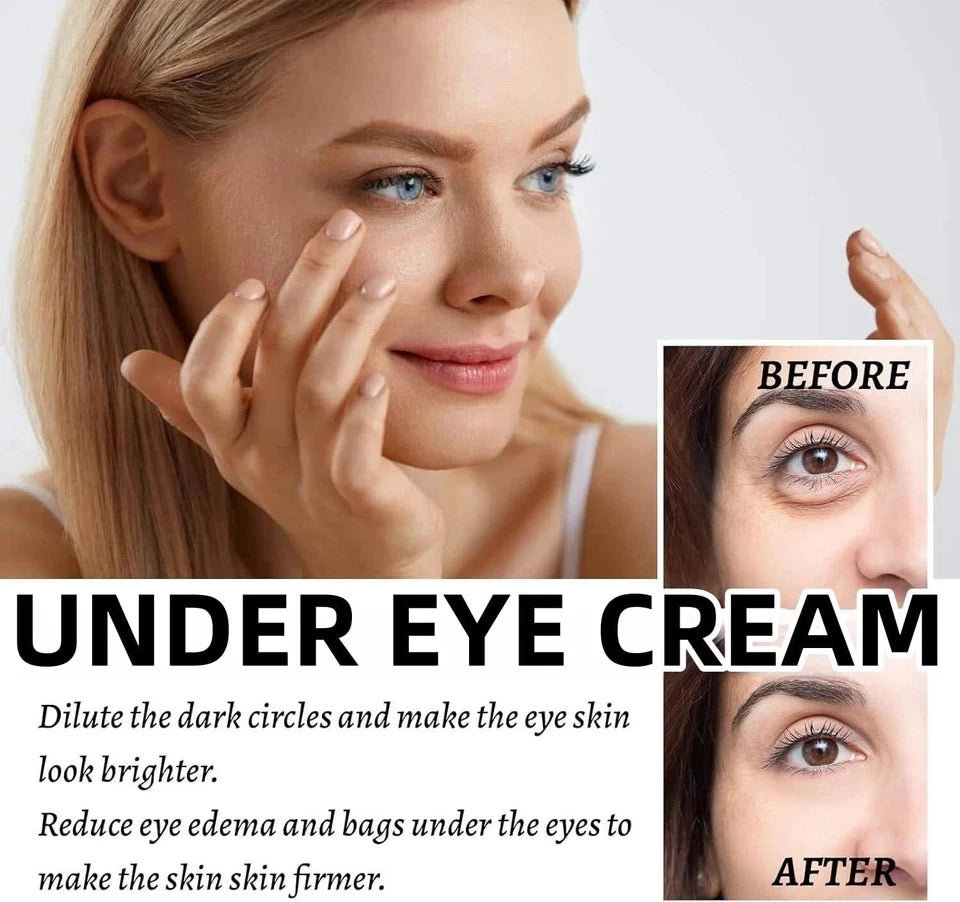 Lumibalm Turmeric & Retinol Eye Stick for Under-Eye Bags
